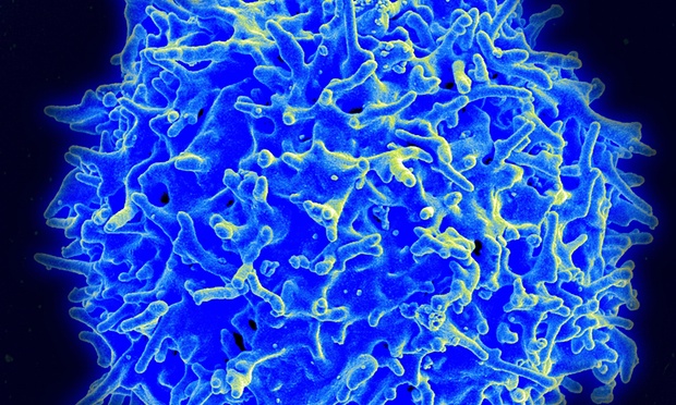 Медики совершили прорыв в лечении лейкемии с помощью иммунных клеток